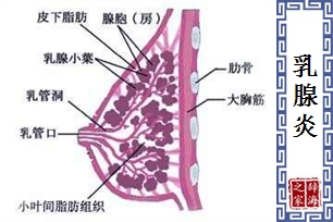 乳腺炎