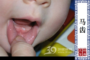 马齿