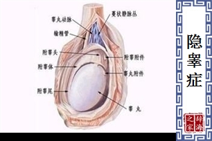 隐睾症