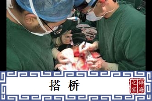 搭桥