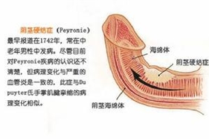 海绵体